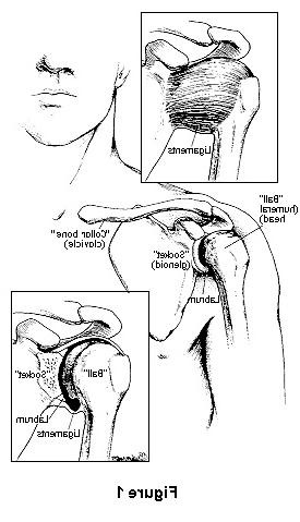 Diagram showing where shoulder instability occurs