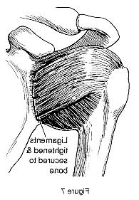 Diagram showing ligaments tightened and secured to bone